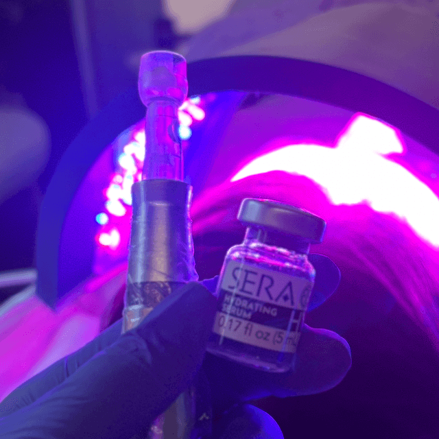 Precision Microneedling at Violet & Ivy Skin Studio in Baltimore, MD